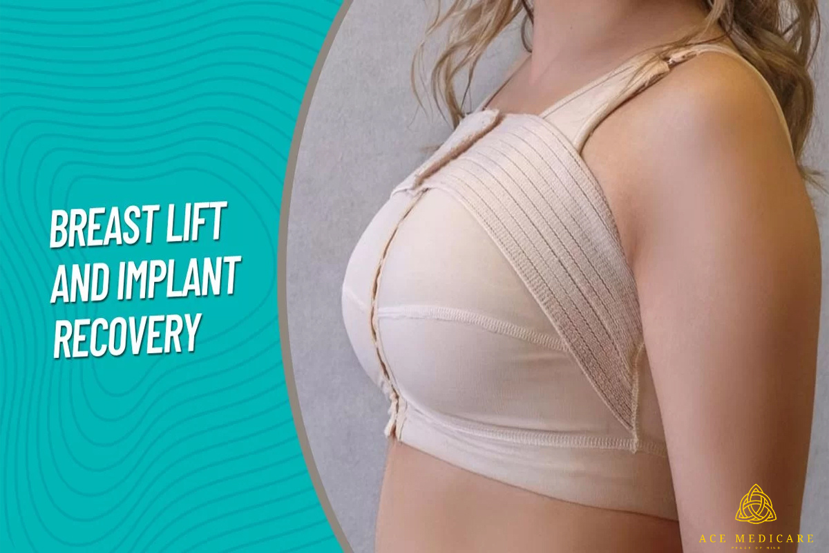 Everything You Need to Know About Breast Lift Surgery: The Ultimate Guide